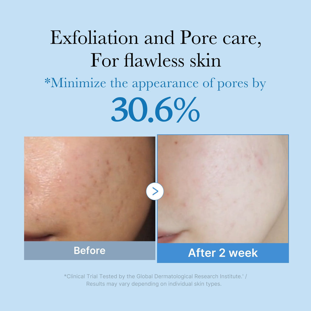 Zero Pore Toner - Simple Glow Care