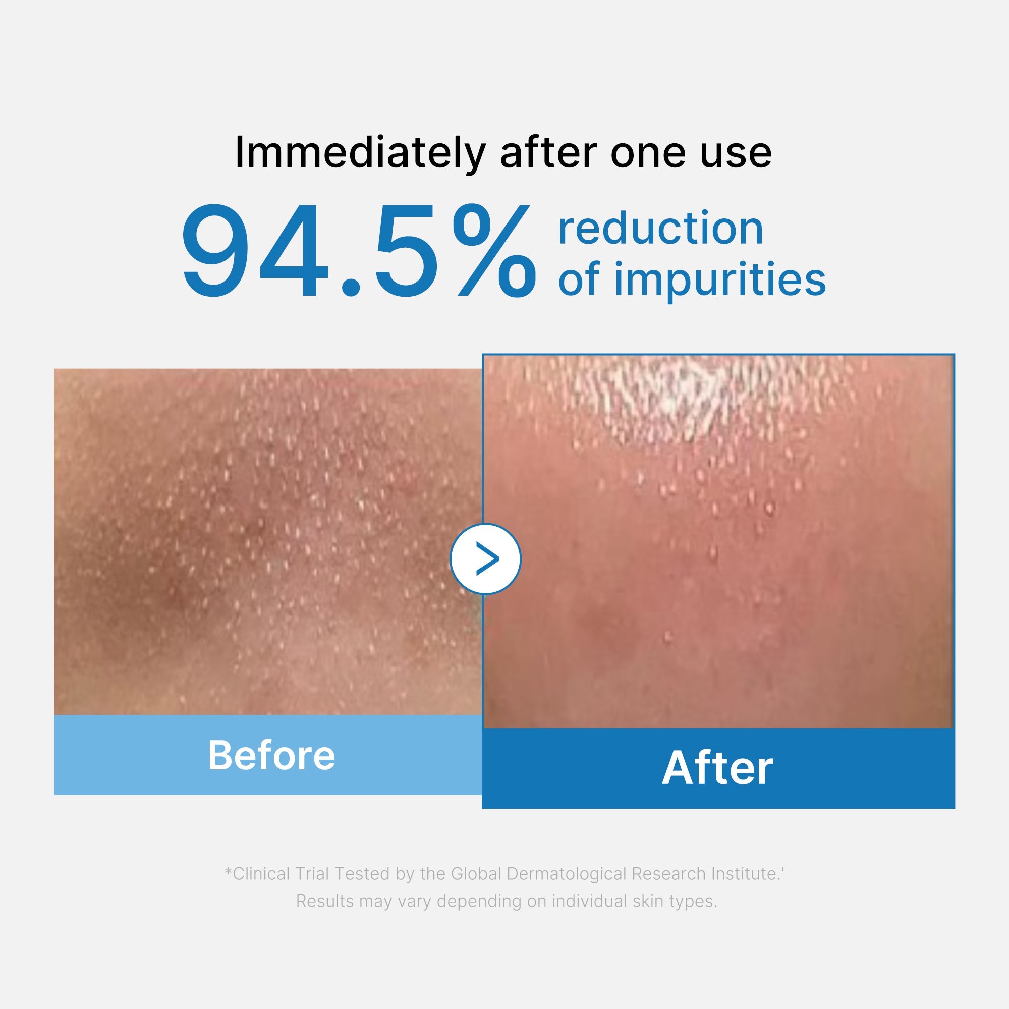 Zero Pore Blackhead Deep Cleansing Oil - medicube.us
