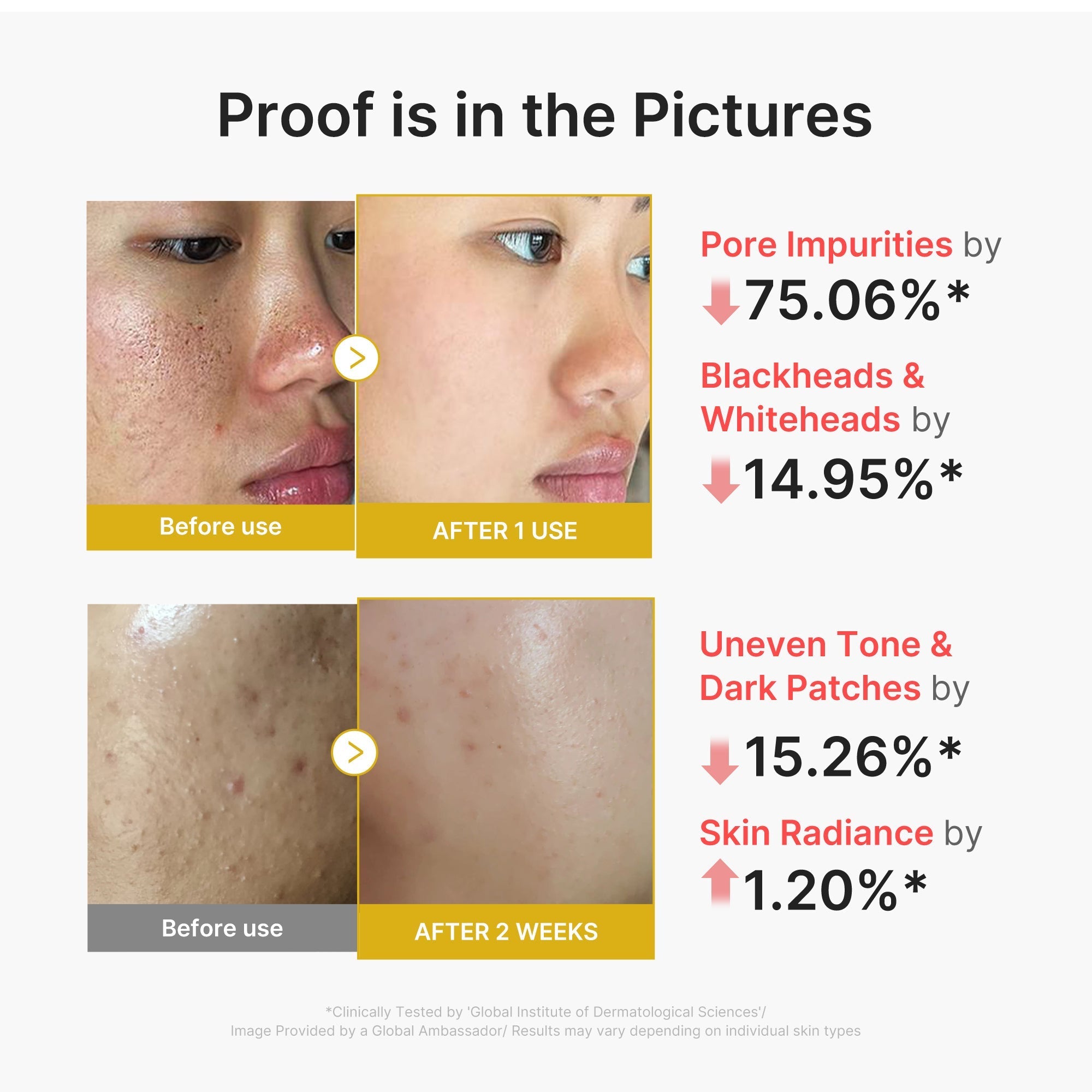 Kojic Acid Turmeric Peel Shot - Feel Skin Ready