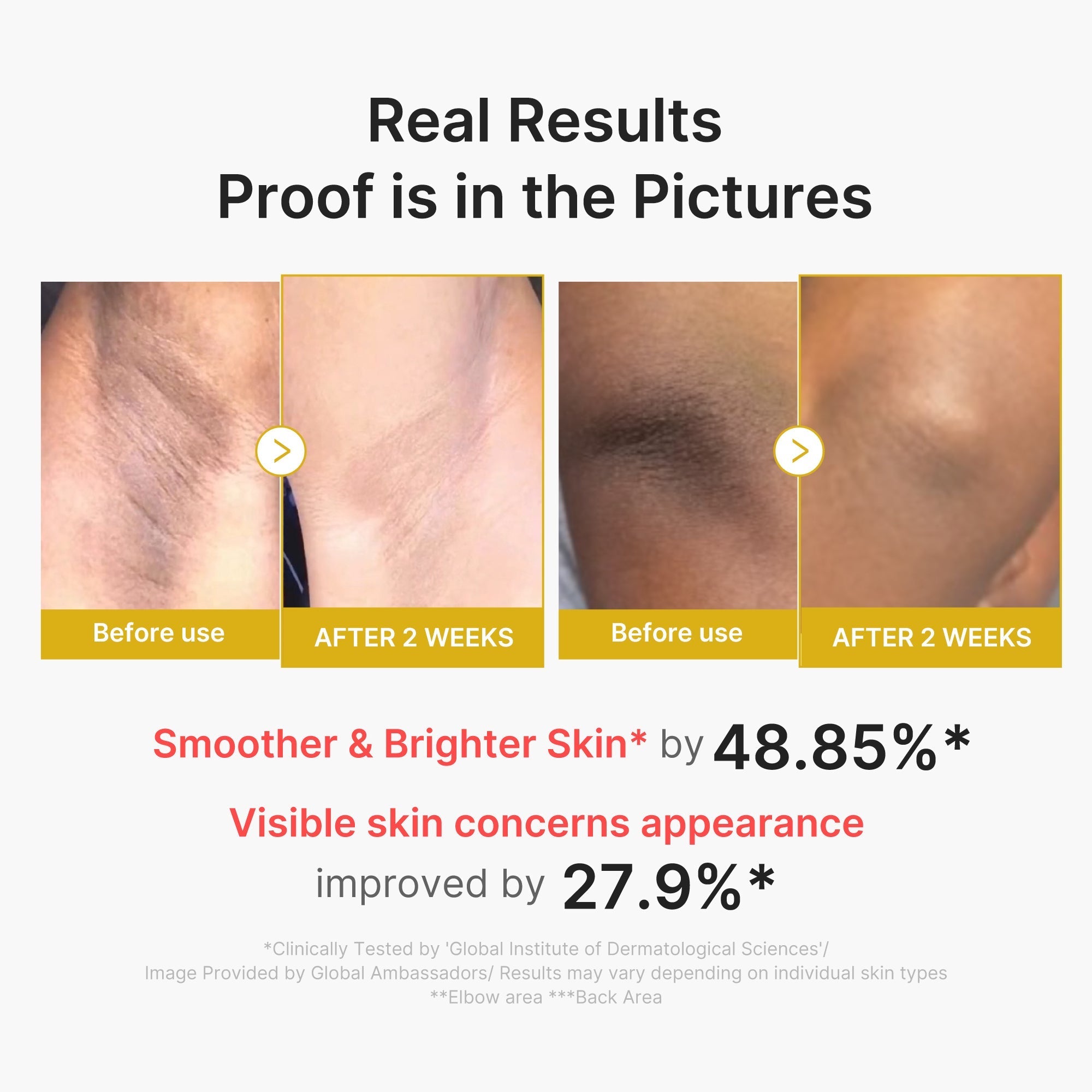 Kojic Acid Turmeric Body Peel Shot - Made for Fresh Skin