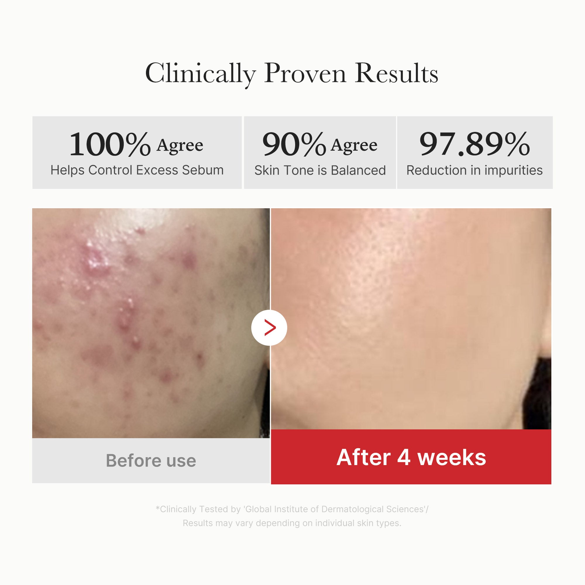 [GIFT] Red Succinic Acid Panthenol Pads - medicube.us