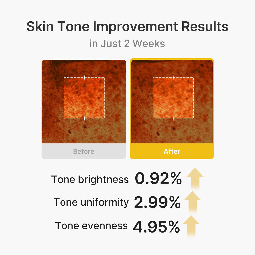 Kojic Acid Turmeric Vita Capsule Cream - Ready for Fresh Skin