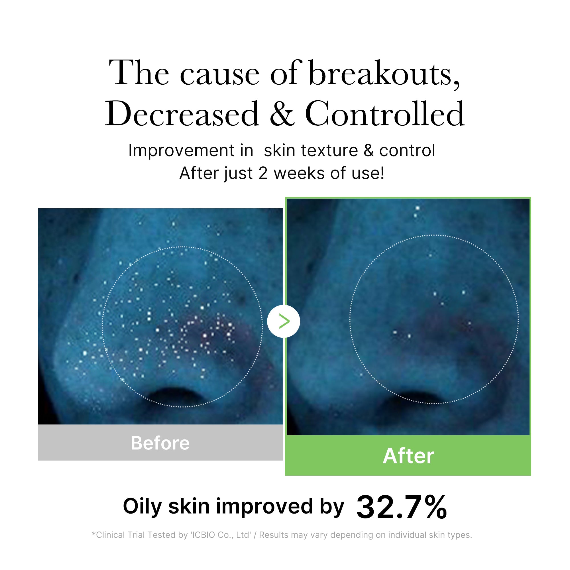 Exosome Cica Calming Toner - Your Skin Routine