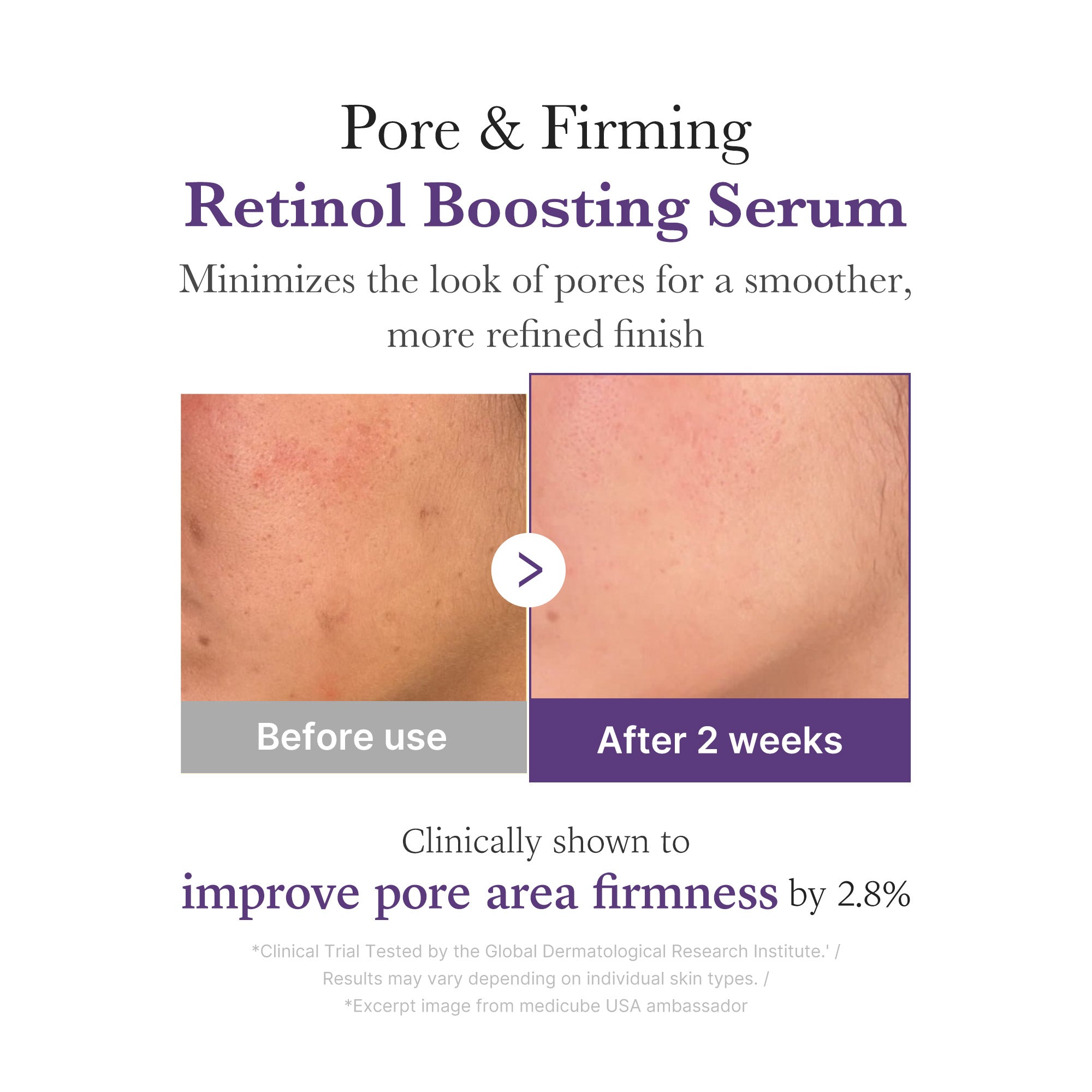 Retinol NMN Boosting Serum - medicube.us