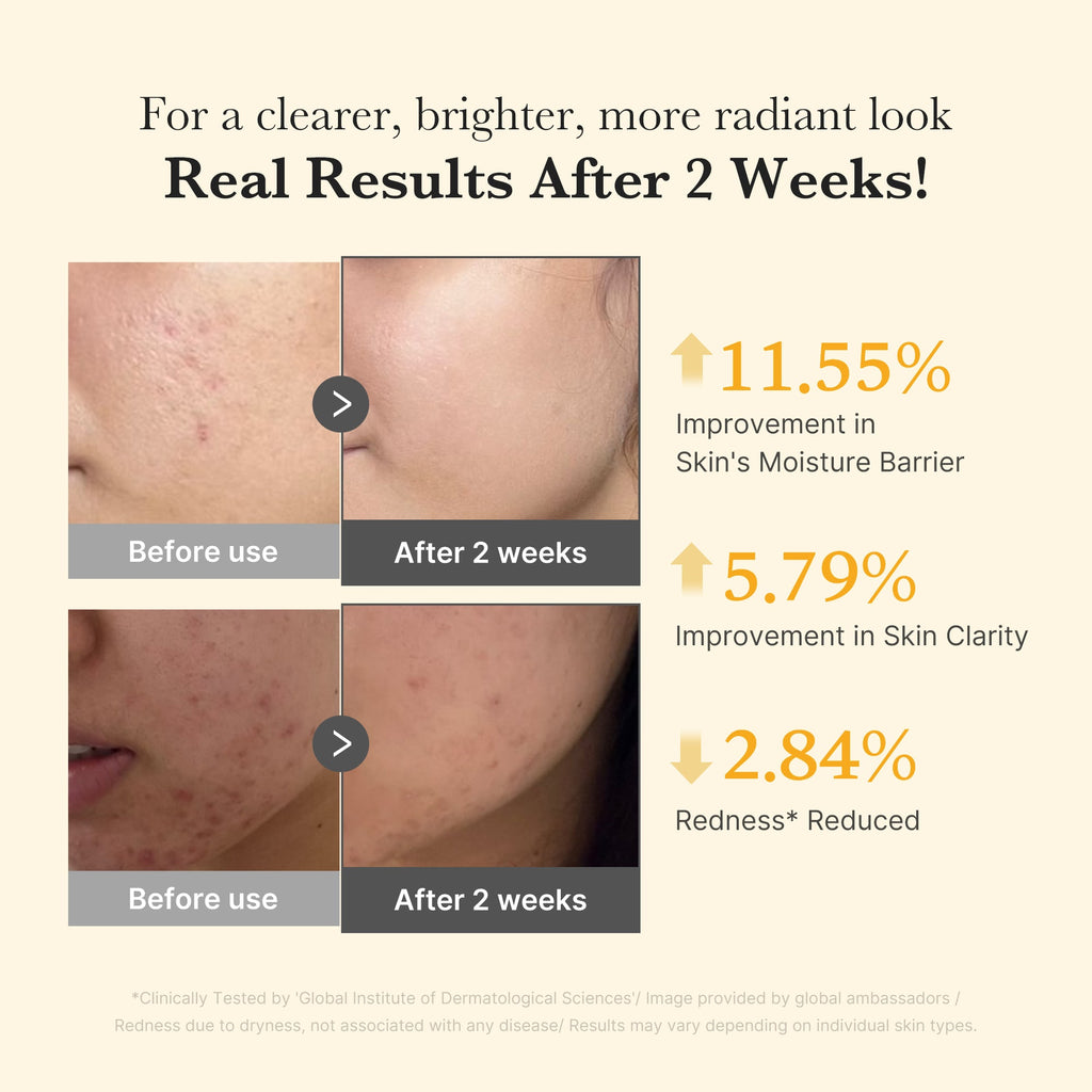 [Subscr.] Kojic Acid Turmeric Capsule Serum - medicube.us