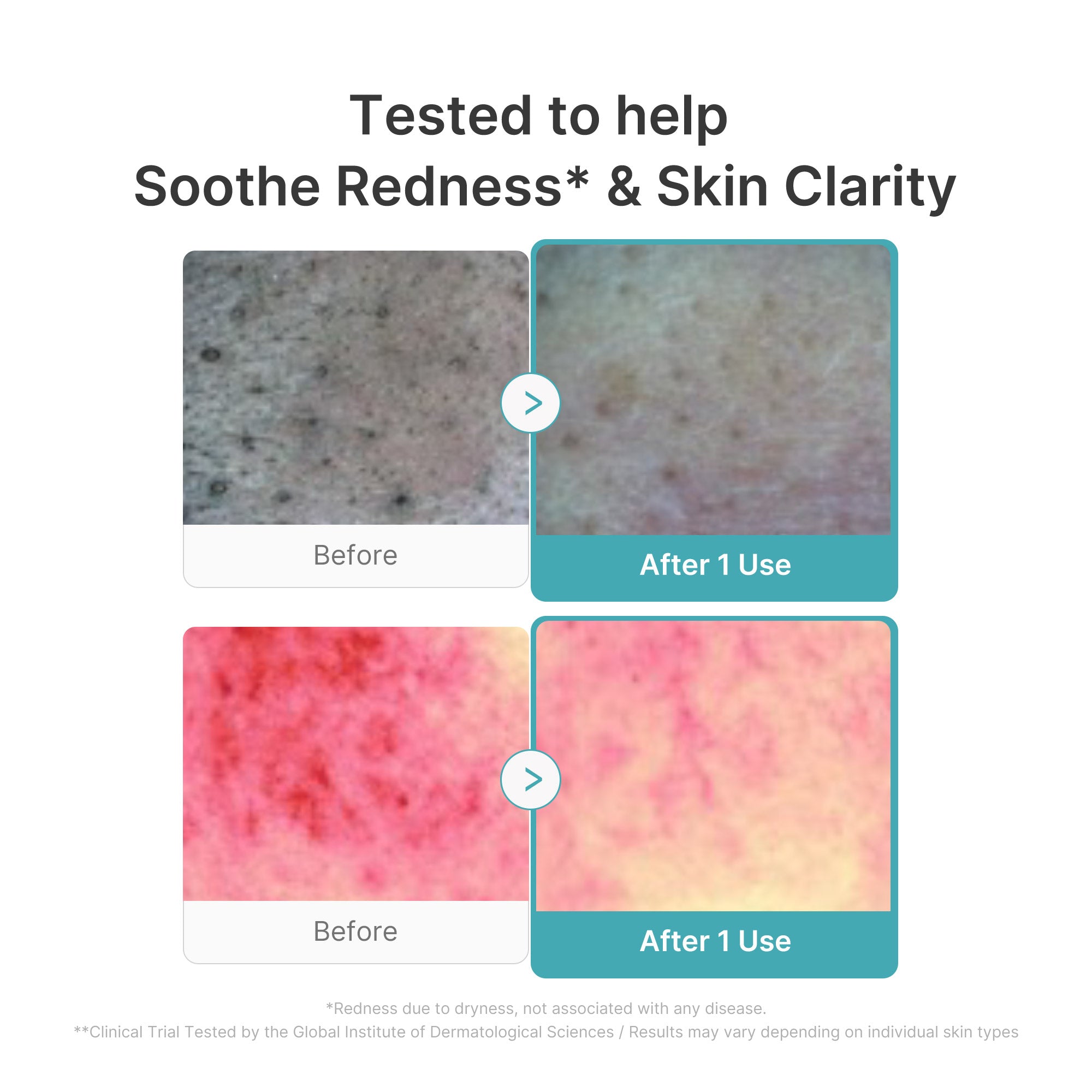 Azelaic Acid Capsule Foam Cleanser - Fresh-Looking Skin
