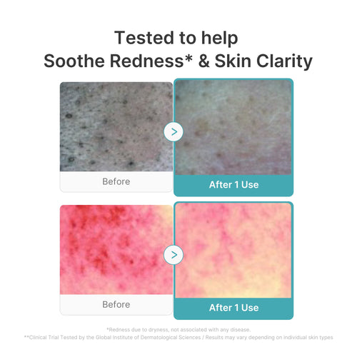 Azelaic Acid Capsule Foam Cleanser - medicube.us