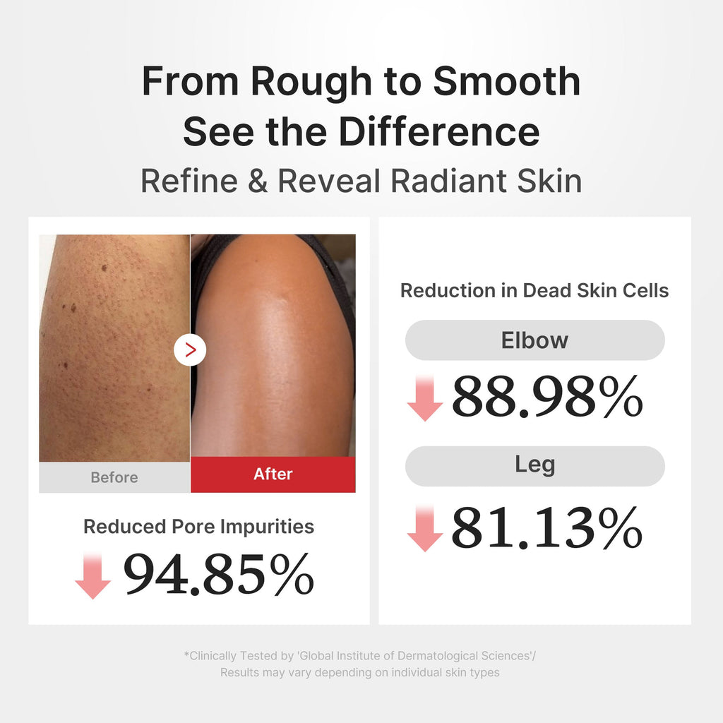 Hypochlorous Acid Rice Body Peel Shot - Skin Care Ready