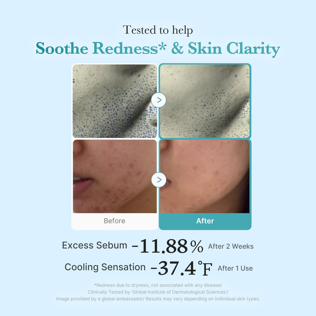 Azelaic Acid Niacinamide Clarifying Toner - Hydration Care Daily