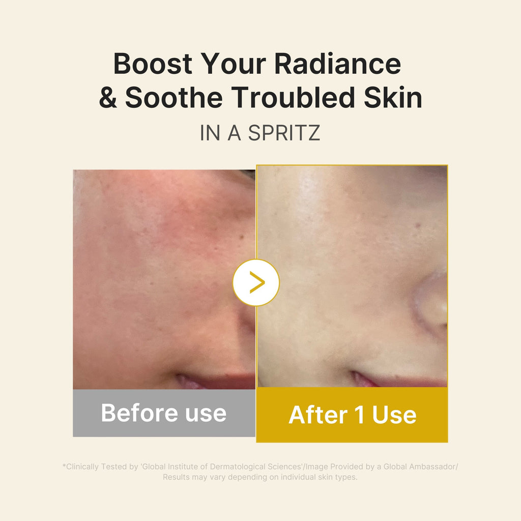 Kojic Acid Turmeric Vitamin Gold Jelly Mist Serum - Daily Glow Essential