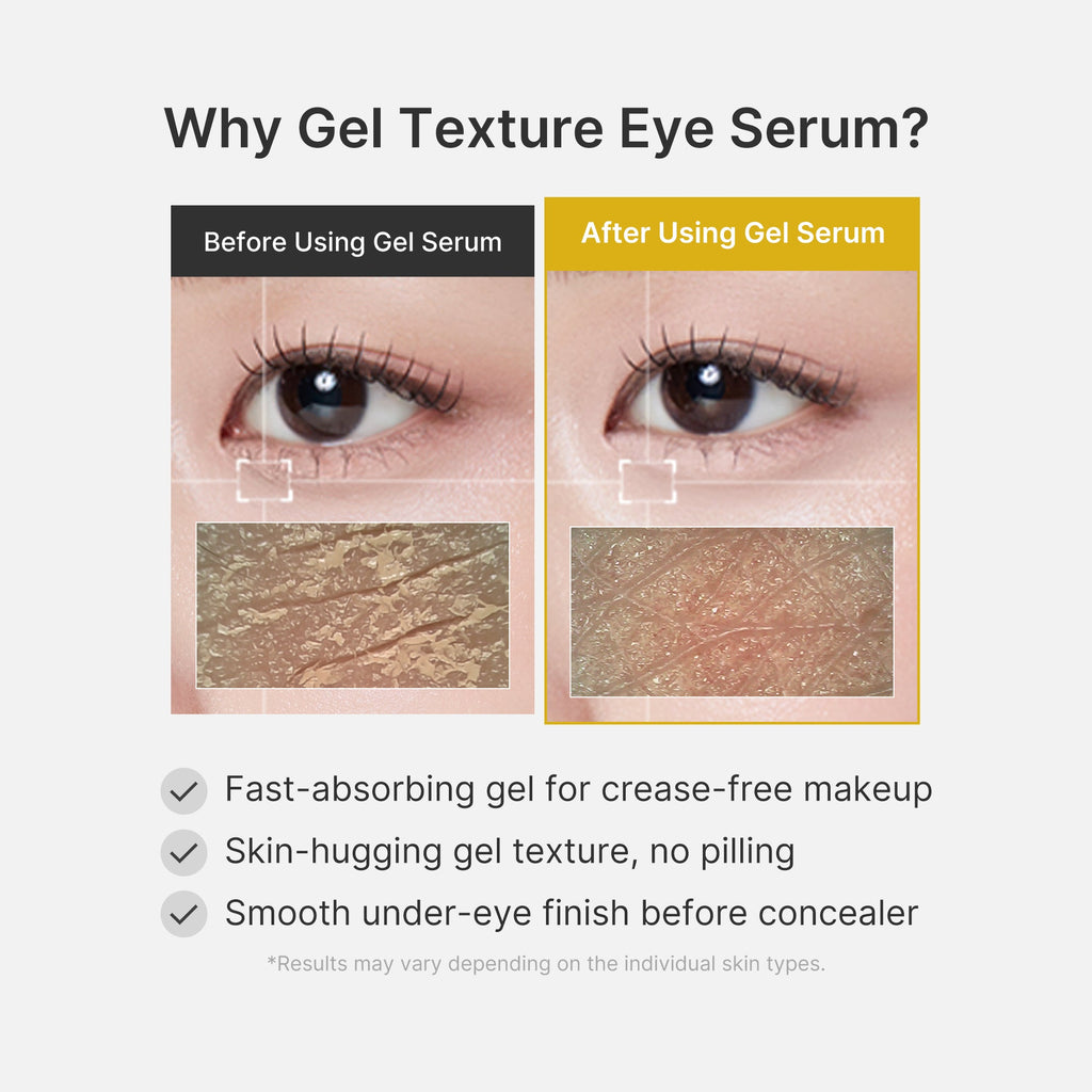 Kojic Acid Tumeric Eye Gel Serum - Fresh Skin Routine