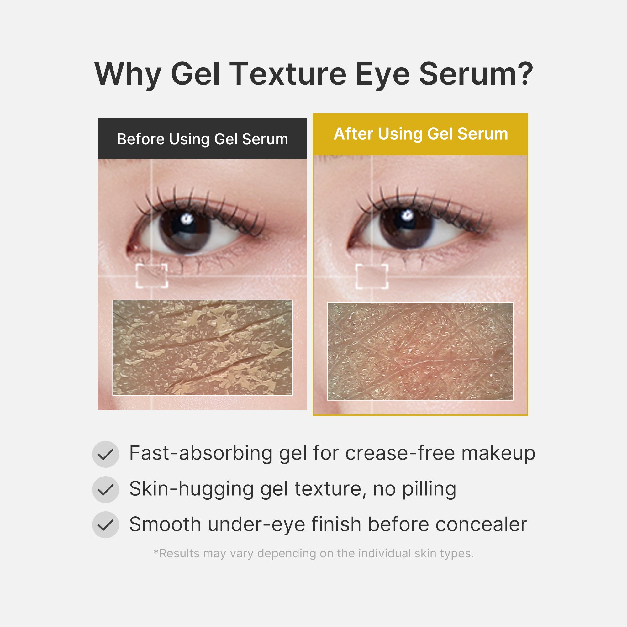 Kojic Acid Tumeric Eye Gel Serum - Fresh Skin Routine