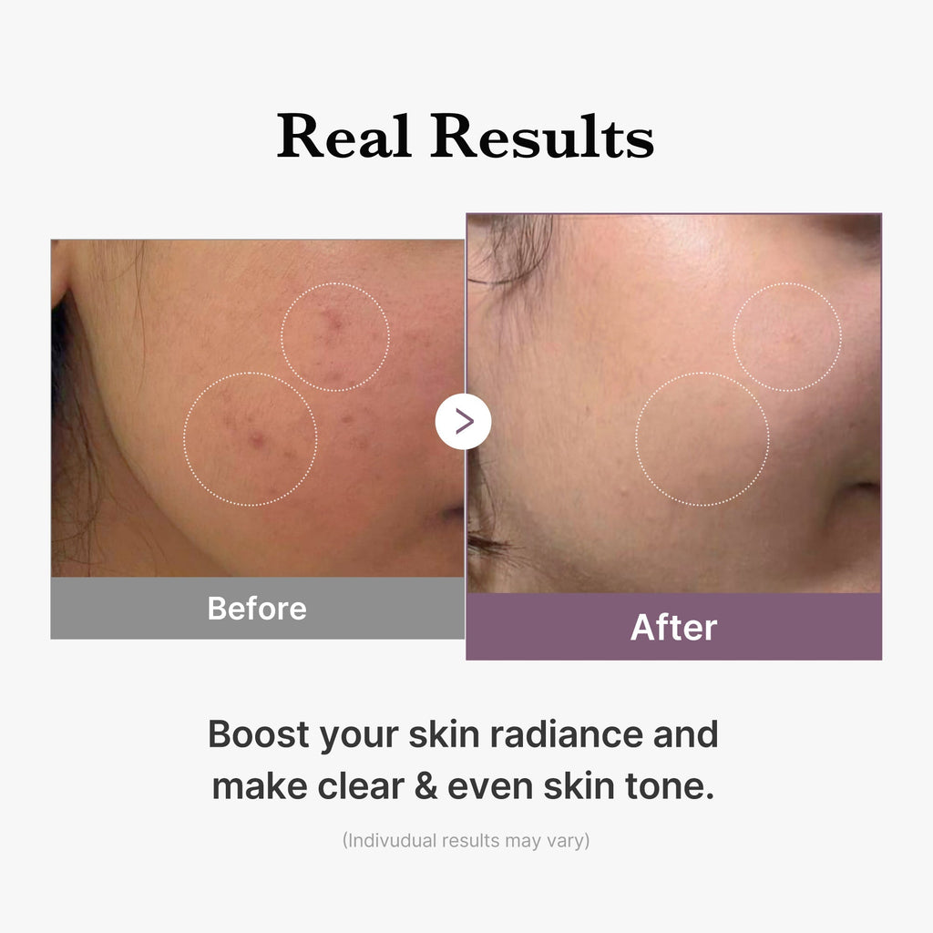AGE-R Glutathione Glow Milk Toner - Beauty Made Easy