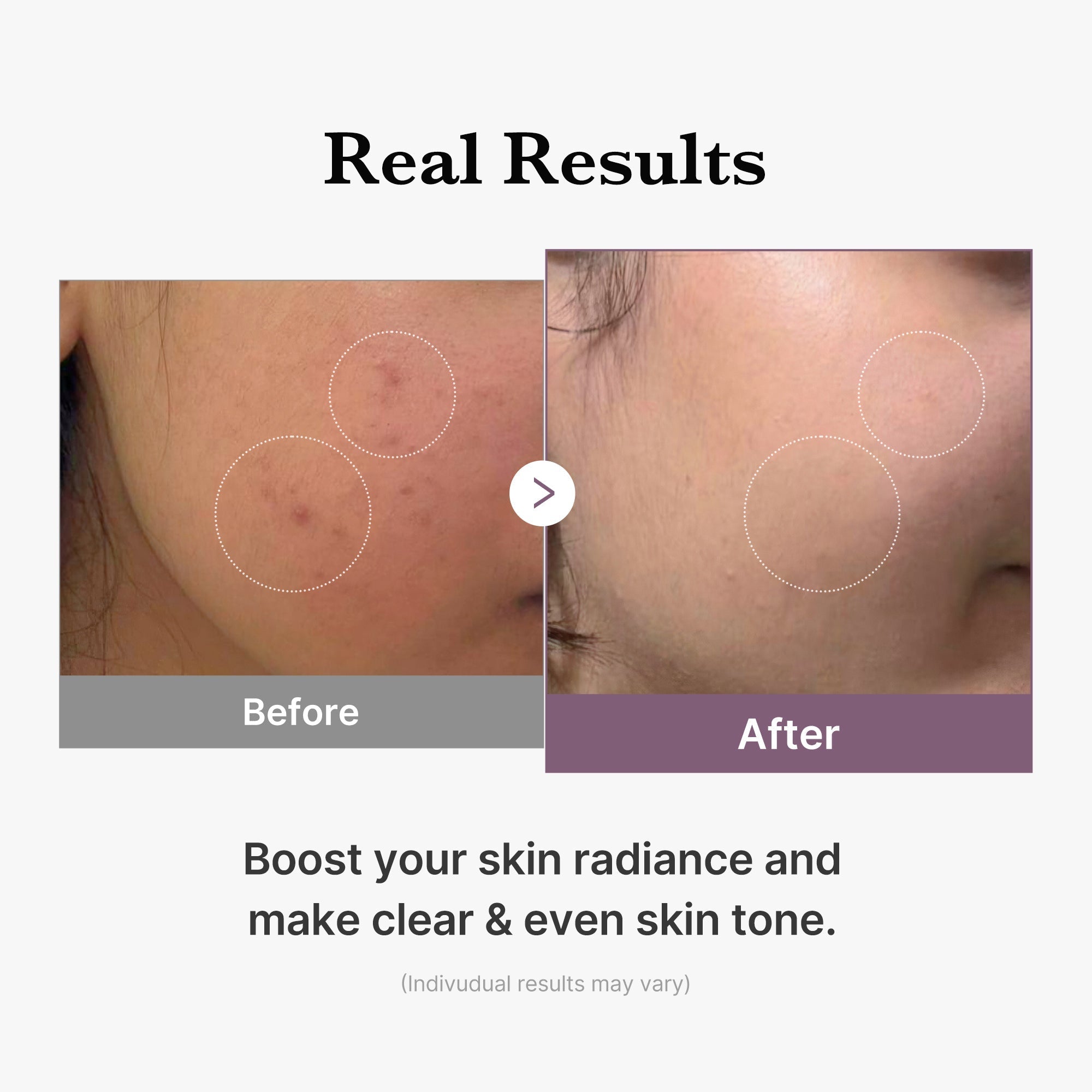 AGE-R Glutathione Glow Milk Toner - Beauty Made Easy