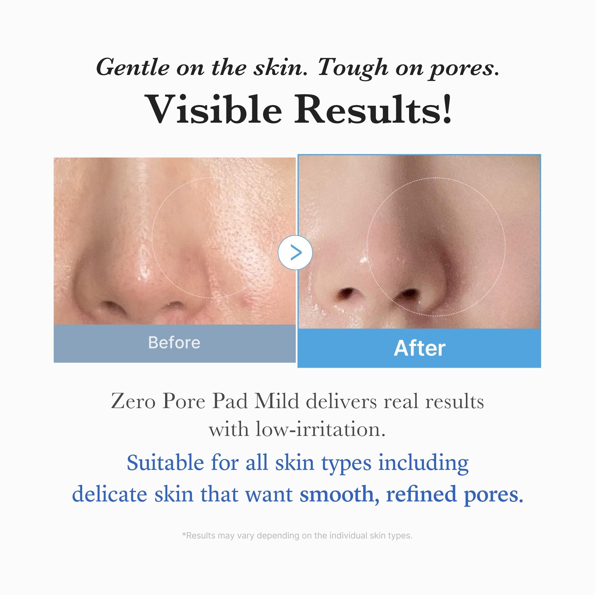Zero Pore Madecassoside Pads (Mild) - Skin Care Ready
