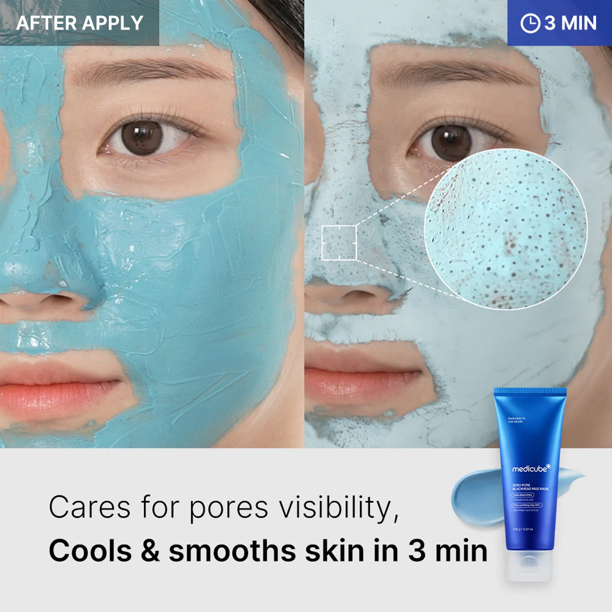 Zero Pore Blackhead Mud Mask - Daily Beauty Care