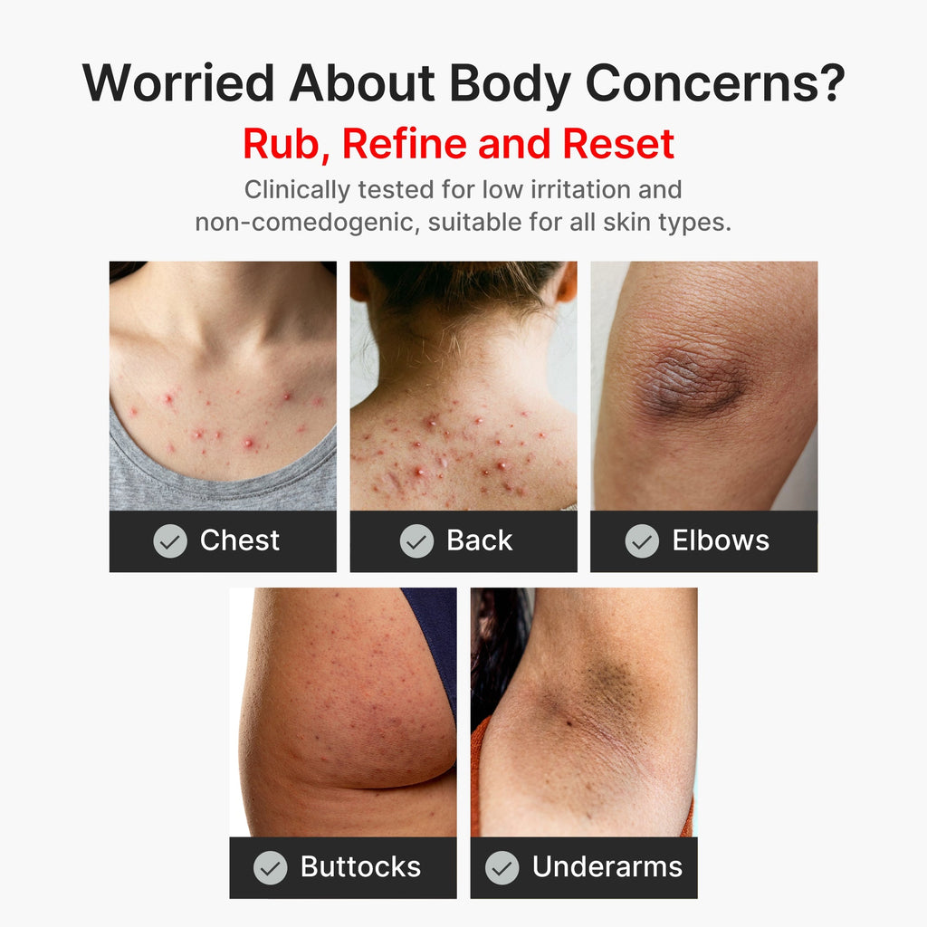 Kojic Acid Turmeric Body Peel Shot - Made for Fresh Skin