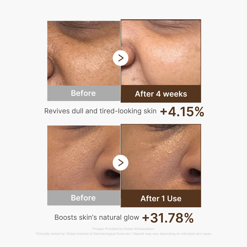 Deep Vitamin C Capsule Serum - Easy Daily Care