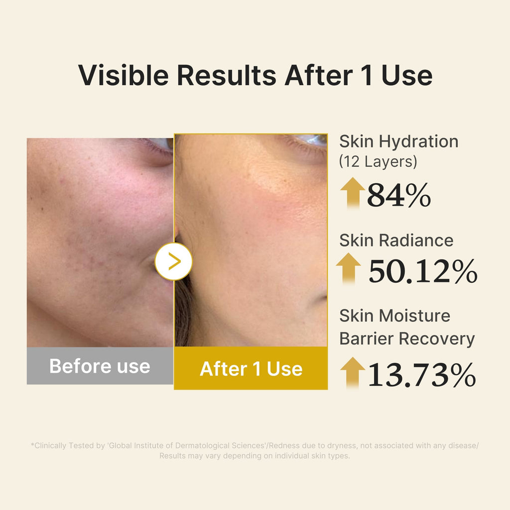 Kojic Acid Turmeric Vitamin Gold Jelly Mist Serum - Daily Glow Essential