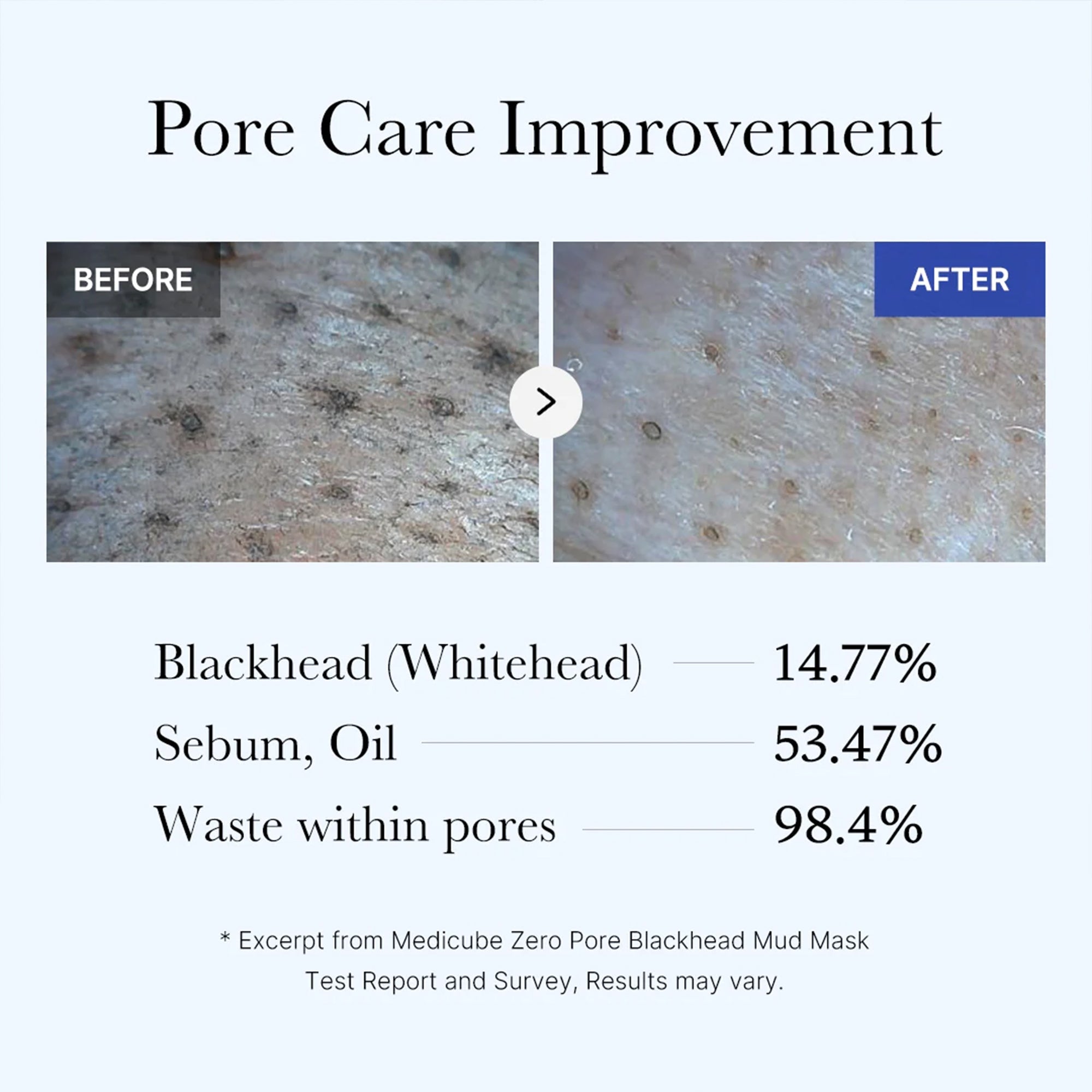 Zero Pore Blackhead Mud Mask - Daily Beauty Care