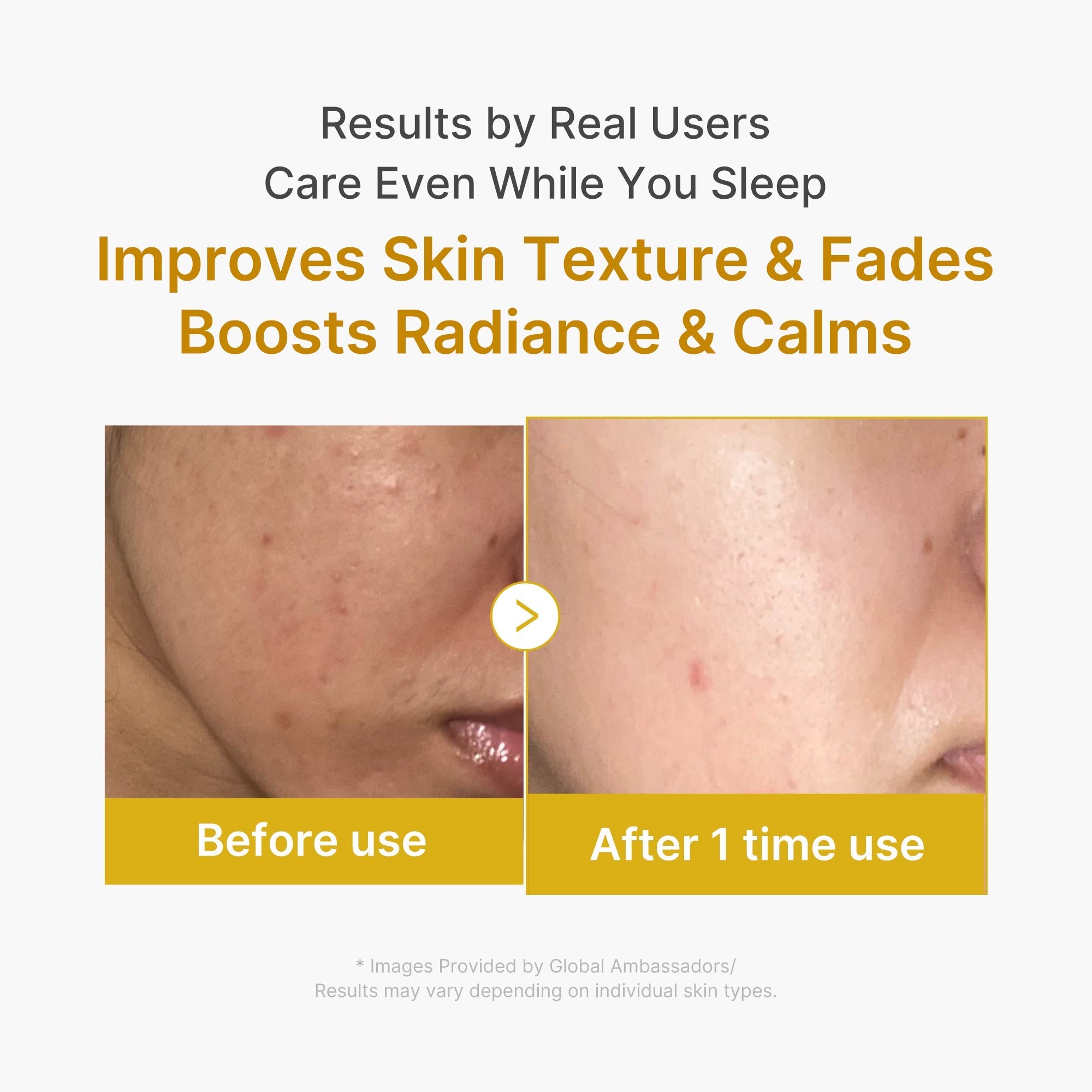 Kojic Acid Turmeric Overnight Wrapping Mask - Skin Care Made Fresh