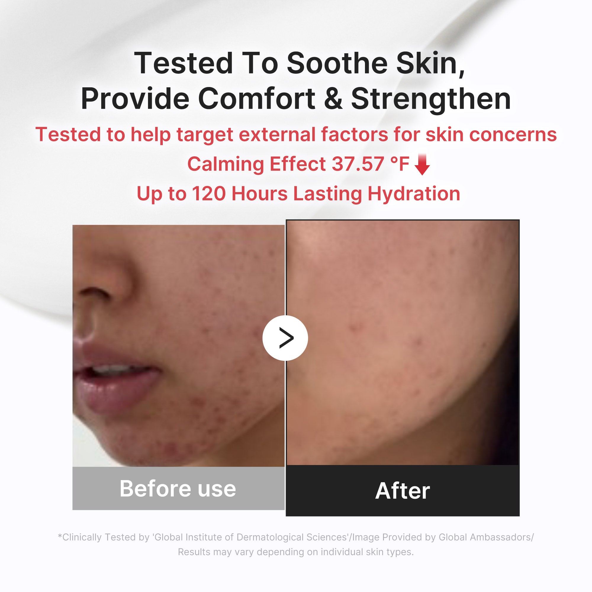 3H Daily Relief Cream M2