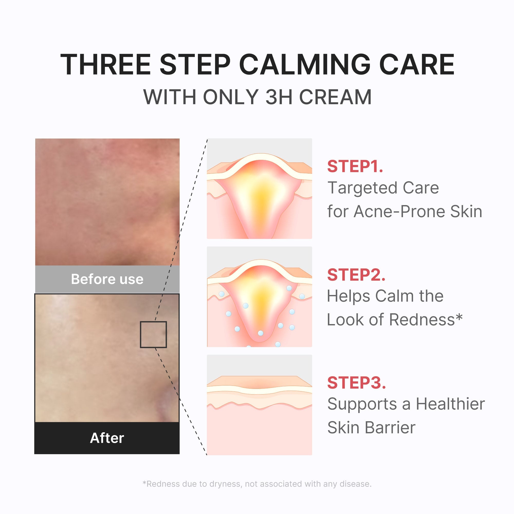 3H Daily Relief Cream M2