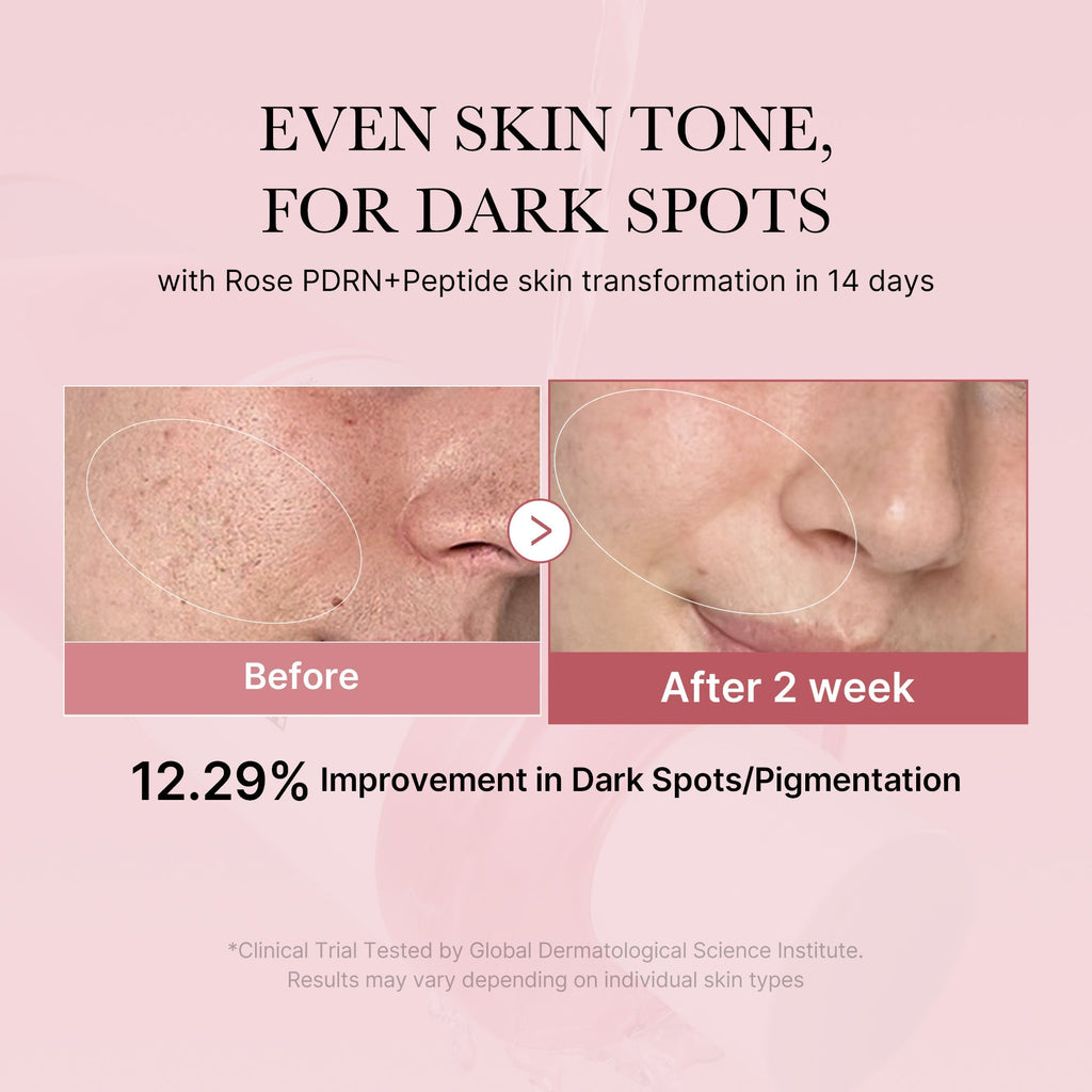PDRN Pink Peptide Toner - Fresh Skin Favorites