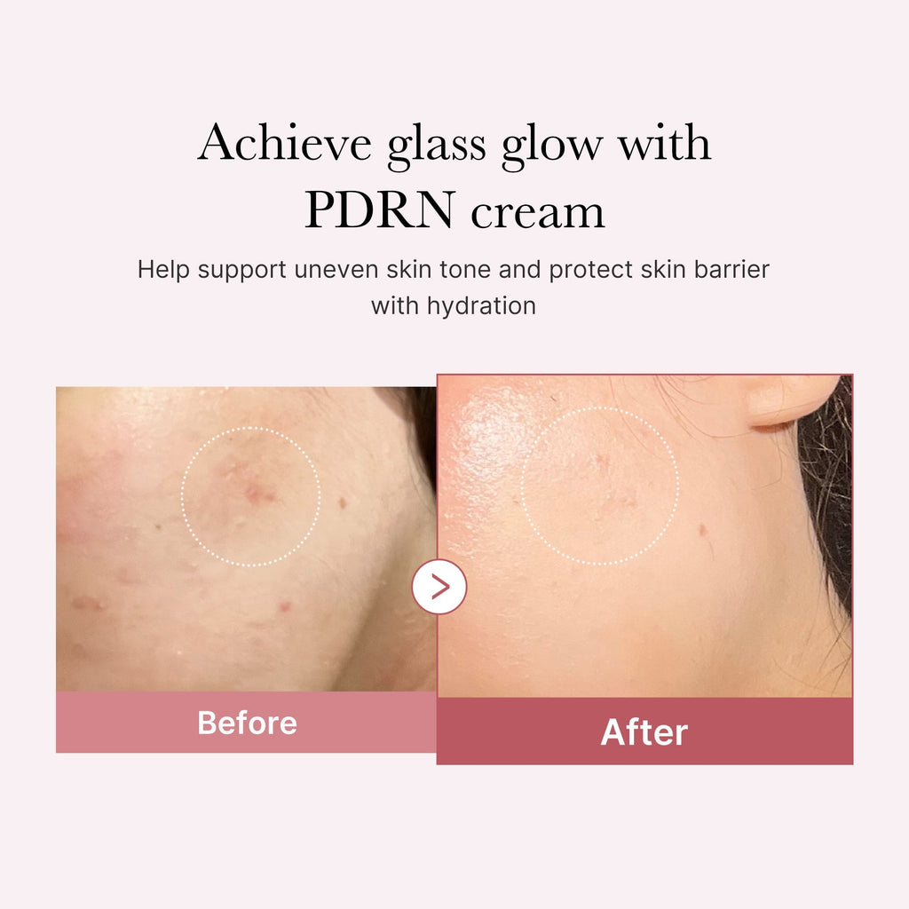 PDRN Pink Peptide Cream - Your Glow Routine