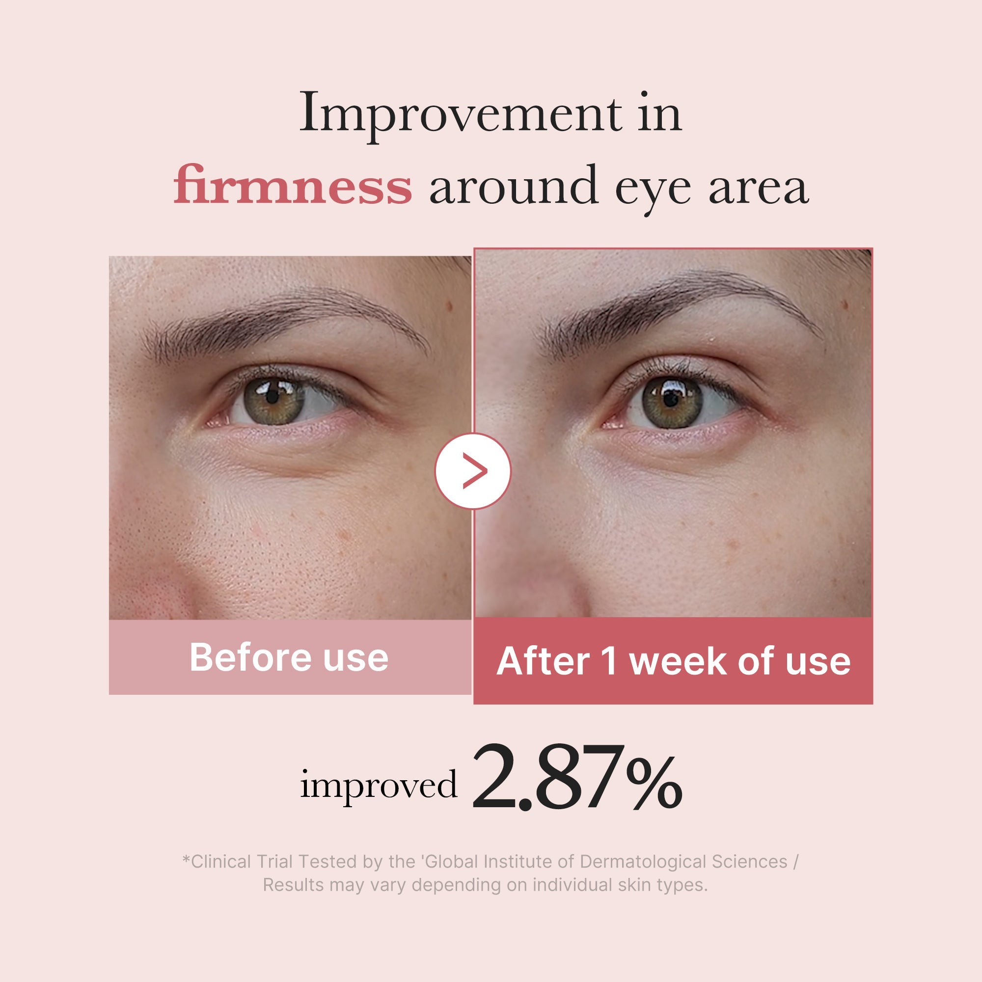 PDRN Pink Peptide Eye Cream - medicube.us