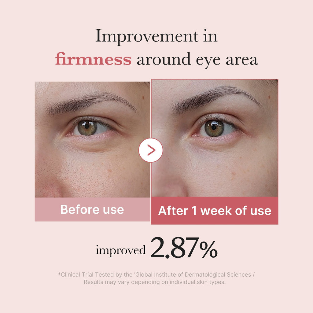 PDRN Pink Peptide Eye Cream - Daily Beauty Care
