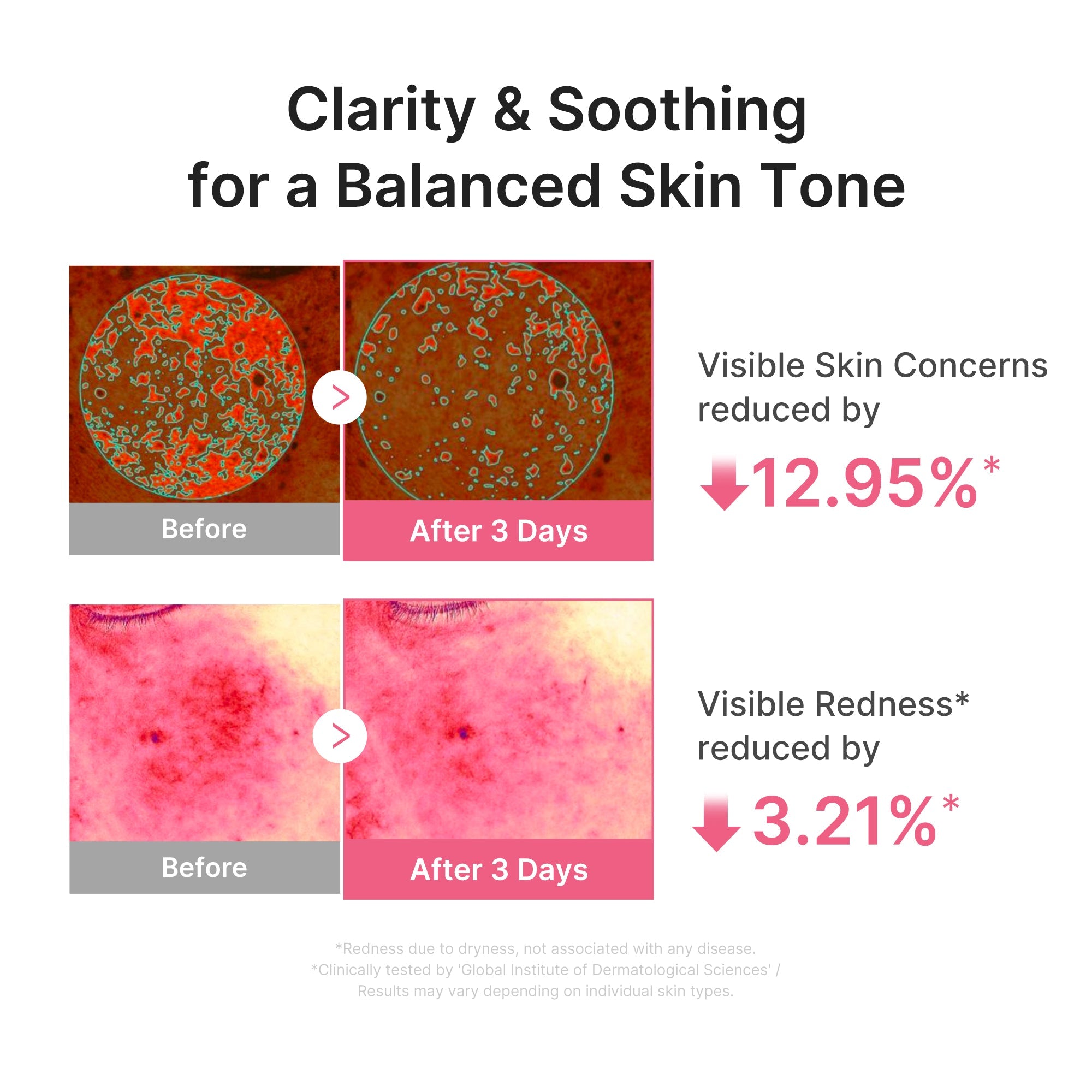 Ultra Light PDRN Pink Peptide Serum RB4