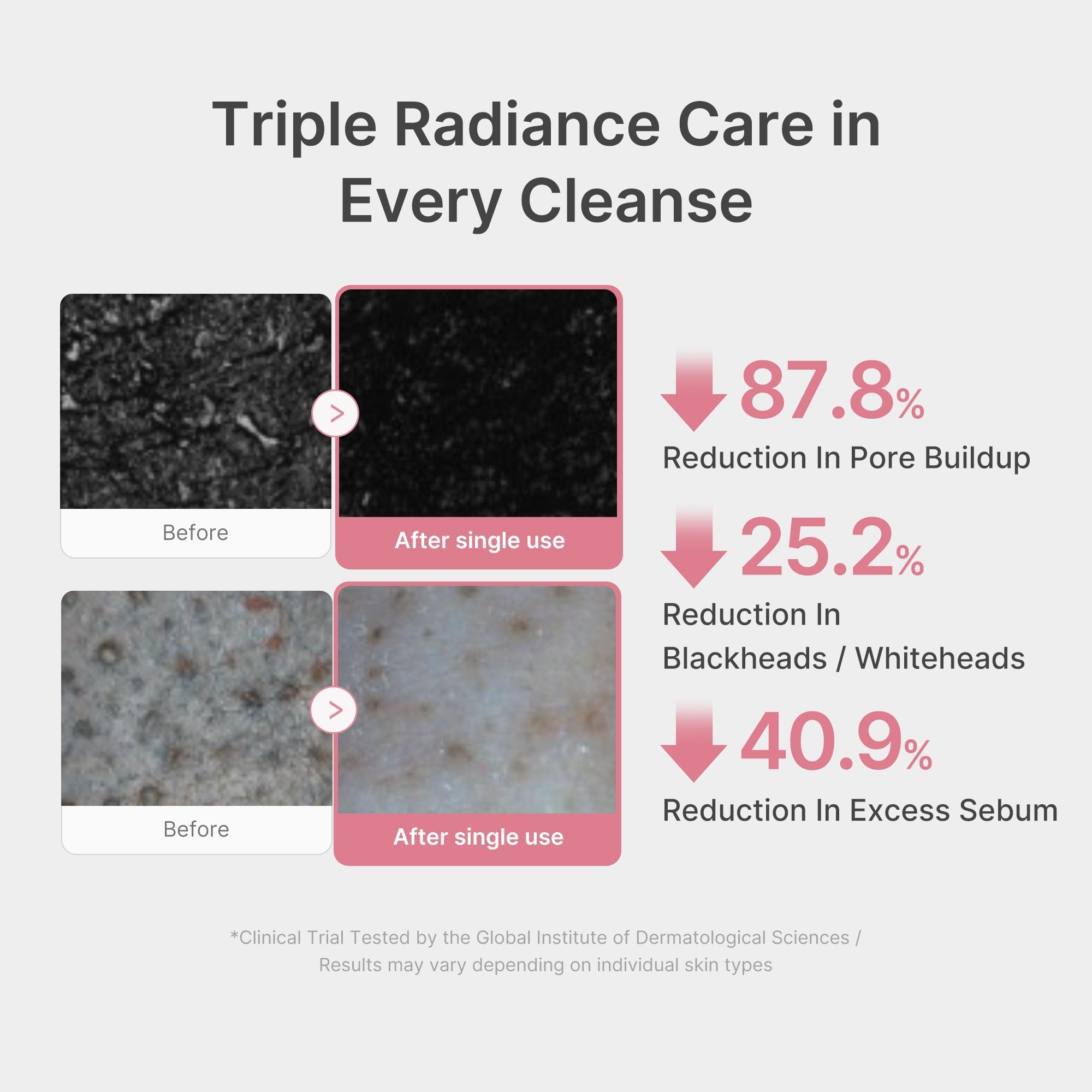 PDRN Pink Glutathione Capsule Foam Cleanser - Modern Skincare