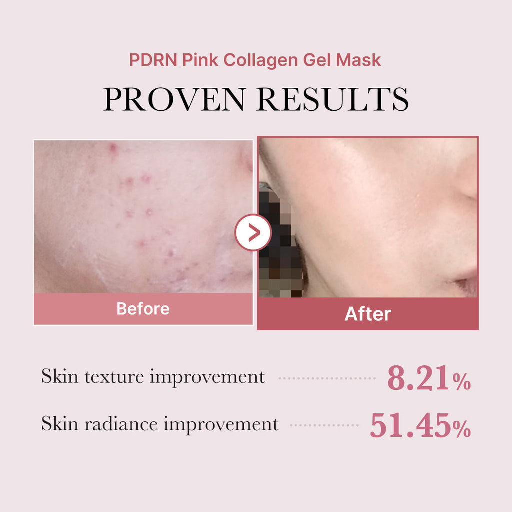 PDRN Pink Glow Full Set - medicube.us