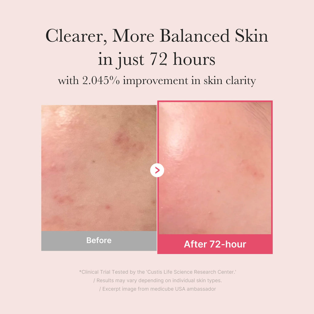 testtesttest - Everyday Skin Refresh