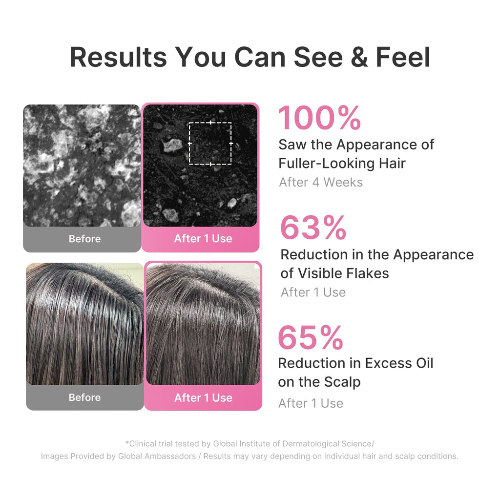 Rosemary PDRN Cooling Thickening Shampoo - Glow for Real Life