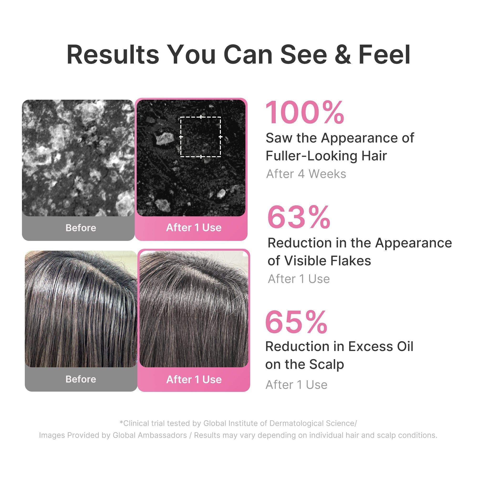 Rosemary PDRN Cooling Thickening Shampoo - Glow for Real Life