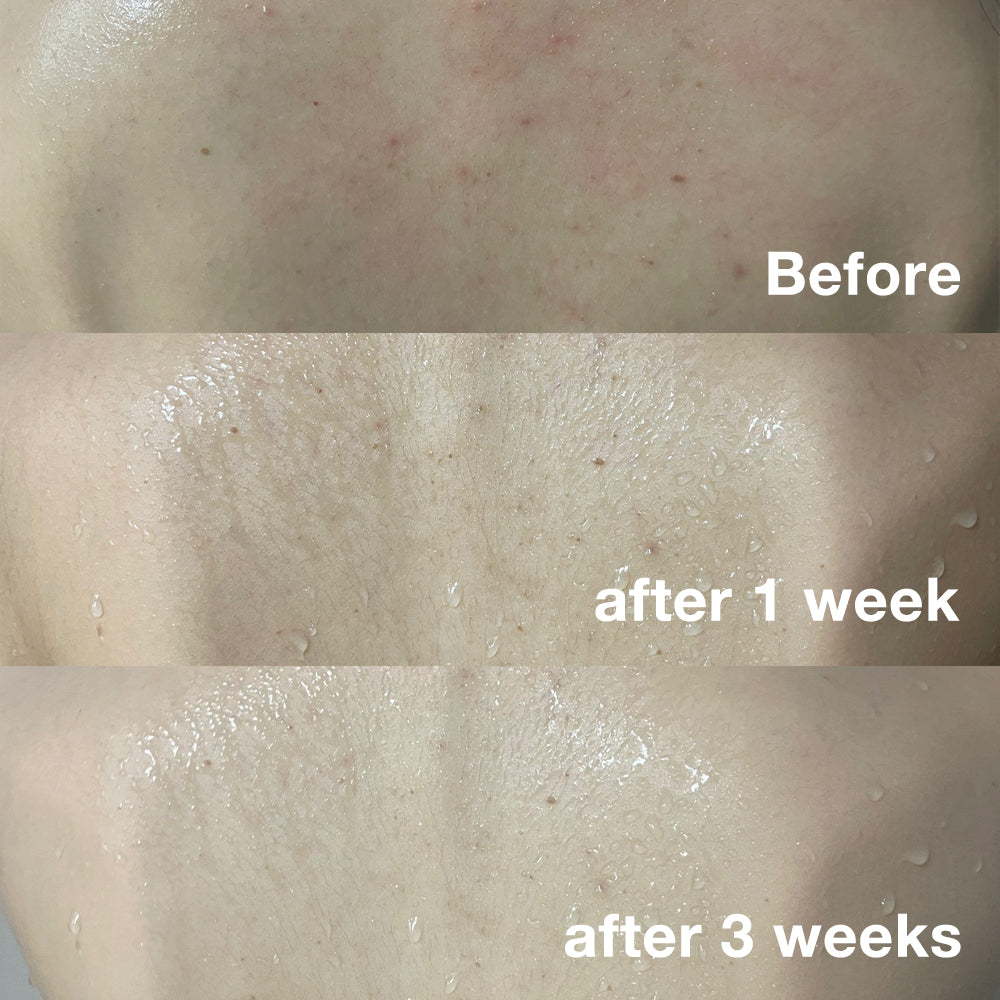 Red Body Wash - Fresh Skin Made Easy