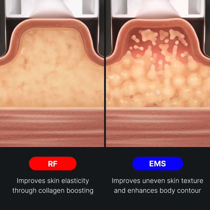AGE-R Contour Body Shot - Simple Skin Routine