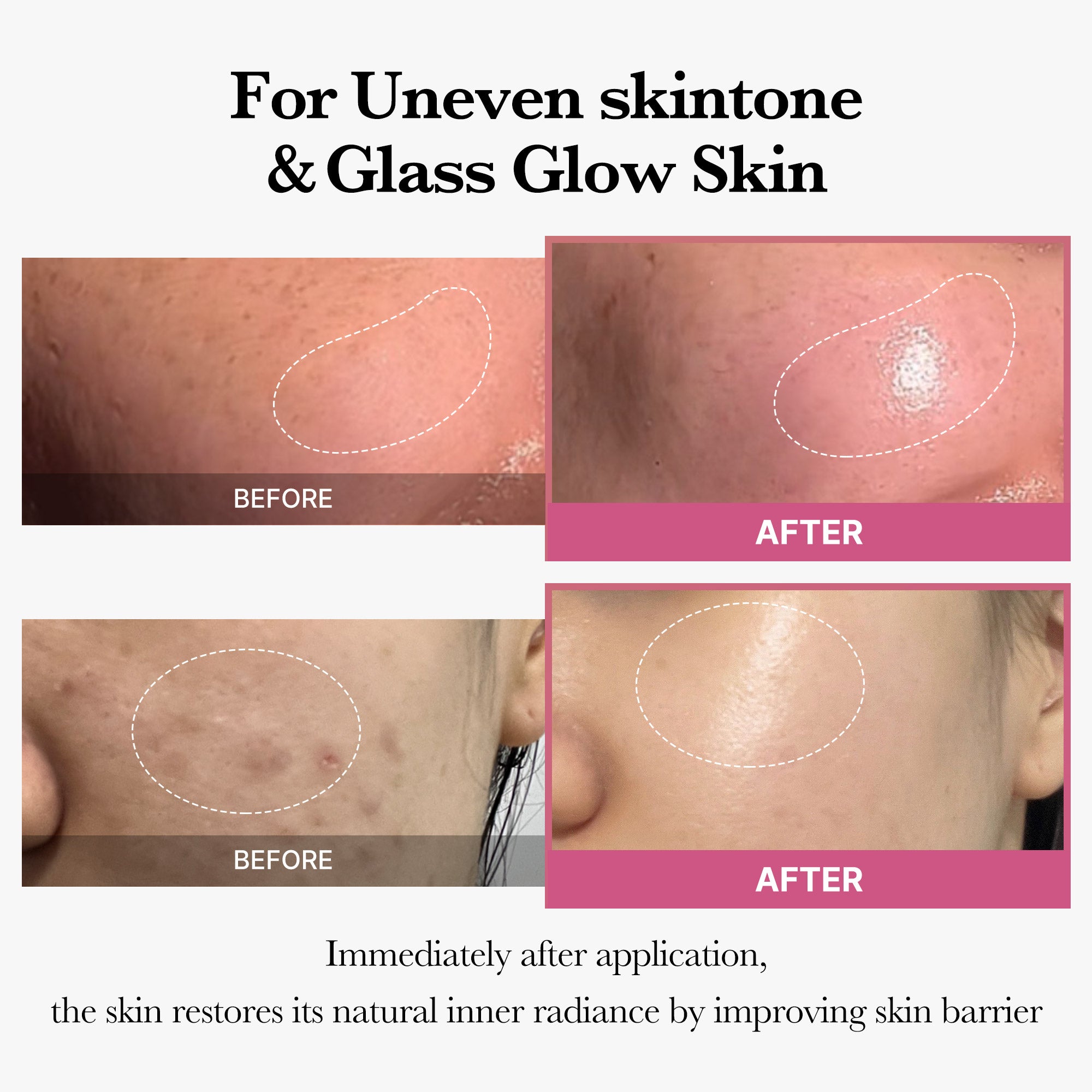 [Tati's Exclusive] Plump Perfection Set - Glow and Go